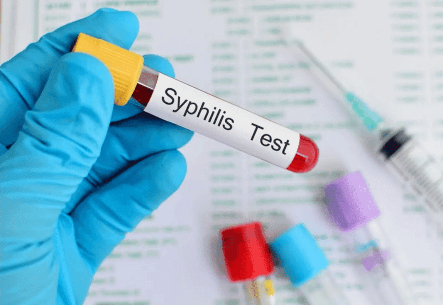 teste de sífilis